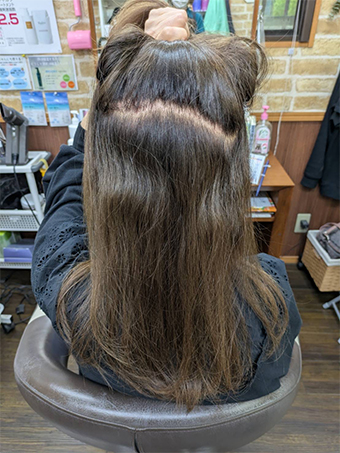 トリートメント施術例