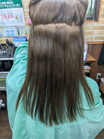 トリートメント施術例