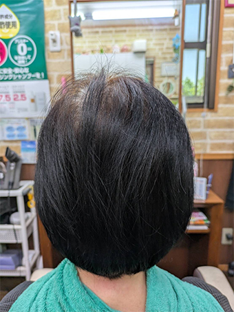 トリートメント施術例