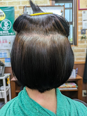 トリートメント施術例