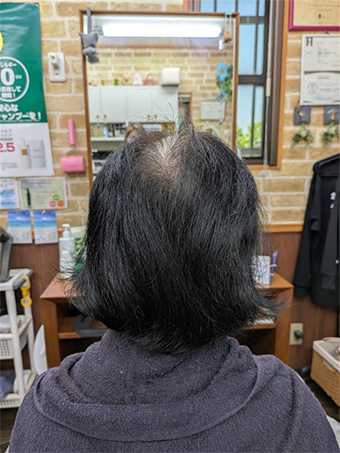 トリートメント施術例