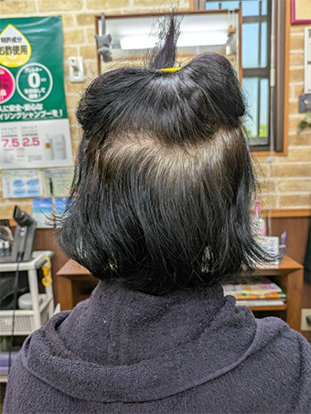 トリートメント施術例