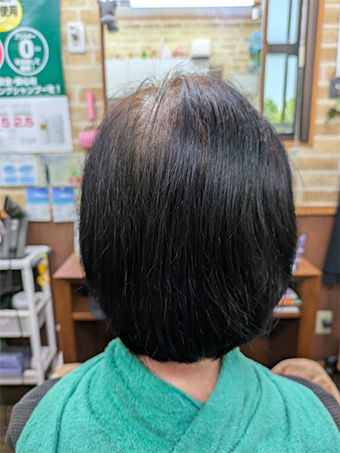 トリートメント施術例