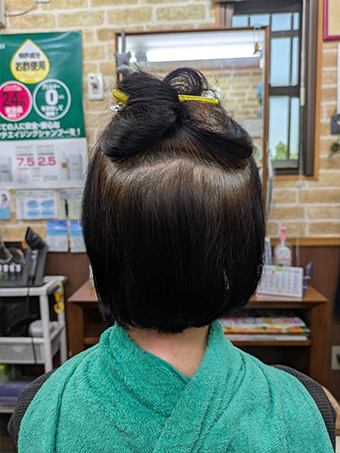 トリートメント施術例