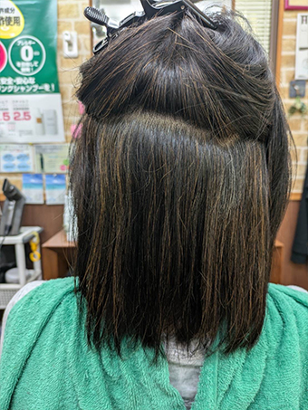 トリートメント施術例