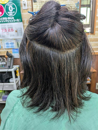 トリートメント施術例