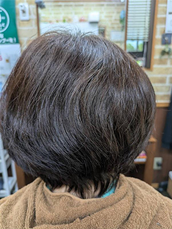 トリートメント施術例