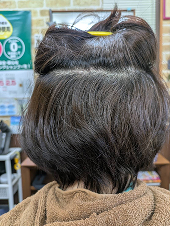 トリートメント施術例