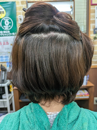 トリートメント施術例